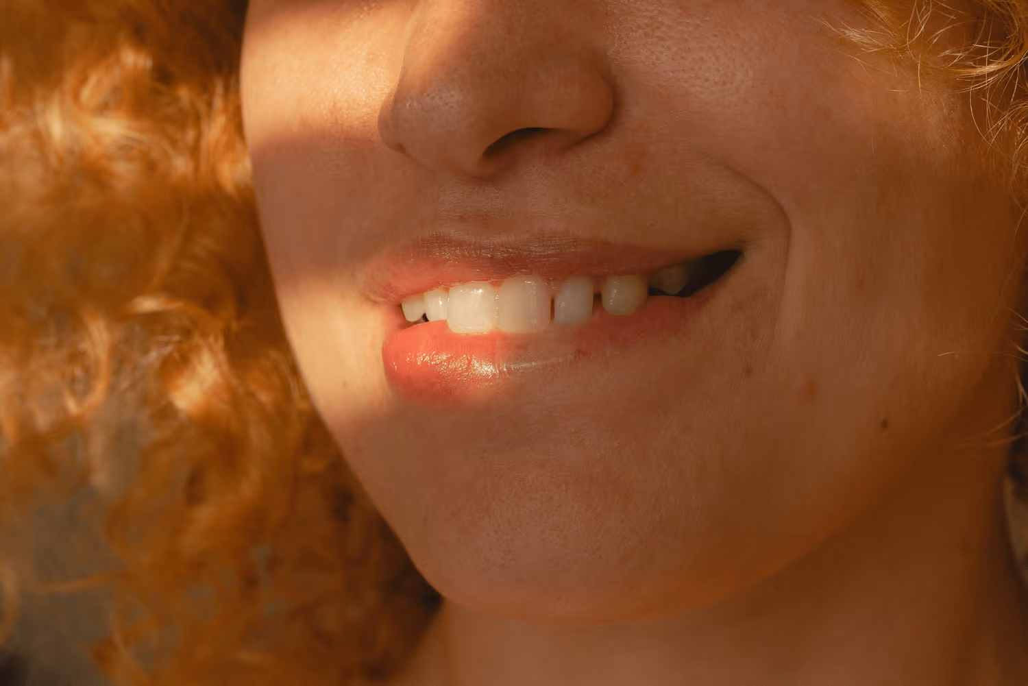 You cannot cure cold sores, but you don’t have to suffer from symptoms. Learn more about prescription and OTC medication and home remedies to treat cold sores.