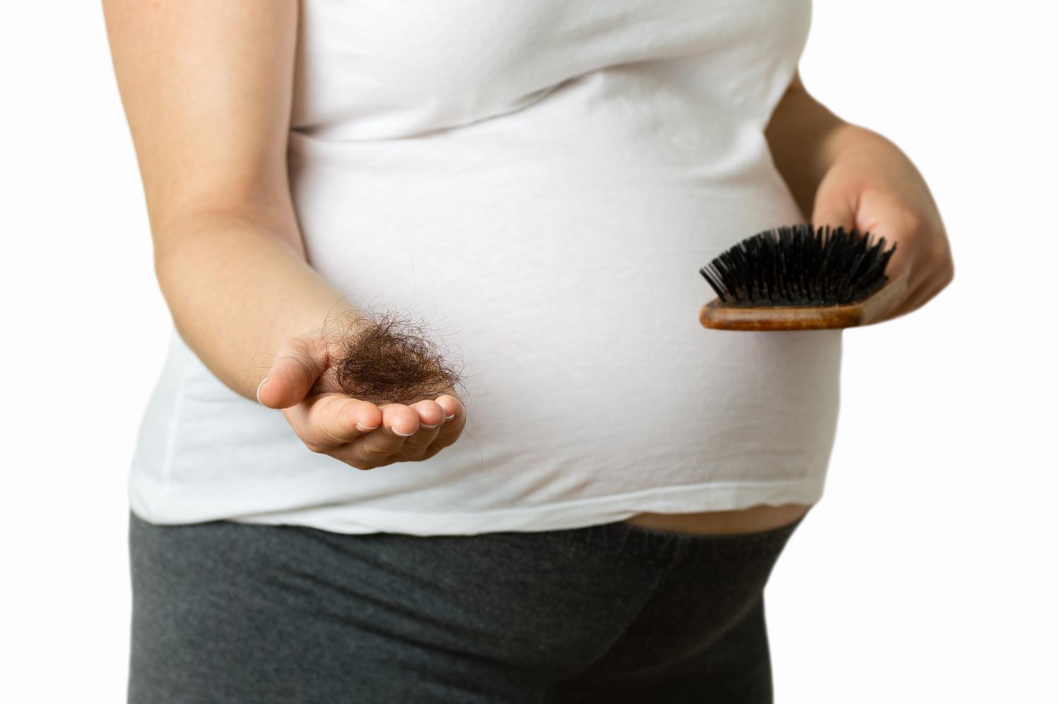 Pregnancy is both a physical and physiological stressor to the body. Thus, hair loss connected to pregnancy usually occurs after delivery. This happens because of the sudden decrease in the hormone estrogen.