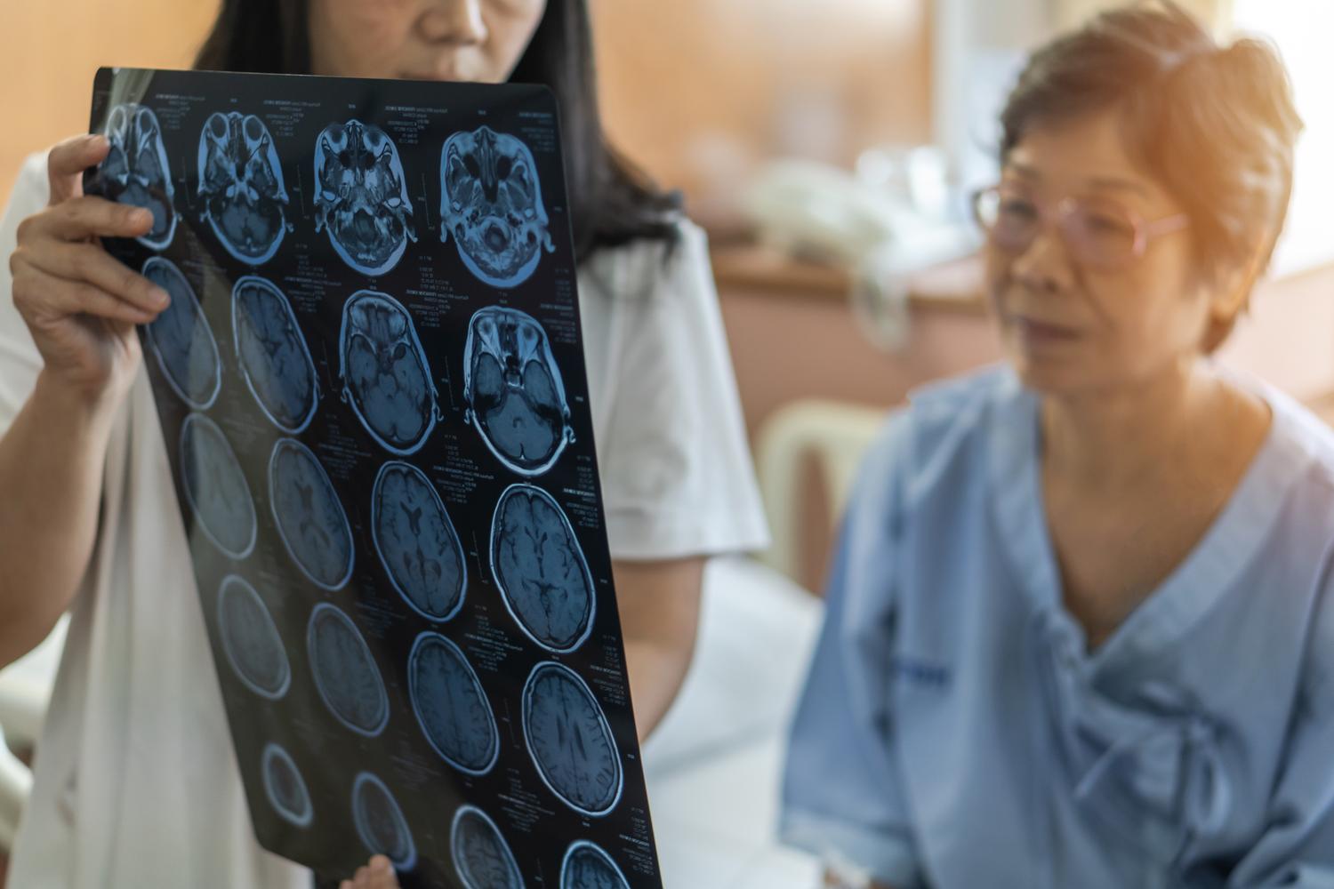 A stroke is a serious medical emergency that can severely impact a person's health and well-being. Read on to learn about common stroke symptoms, what it feels like to have a stroke, different risk factors and ways you can reduce your risk of a stroke.